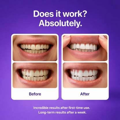 Teeth Whitening Strips – Fast Results, Zero Sensitivity 1pack（Buy 1 get 1 free）